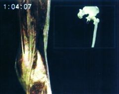 DVD版　機能解剖マニュアル　下肢1(股関節/膝関節)