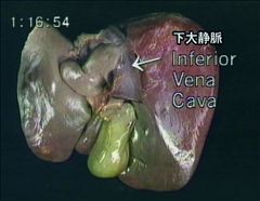 DVD版　機能解剖マニュアル　腹部の臓器(胃腸管/肝臓/膵臓/腹部血管/泌尿器)