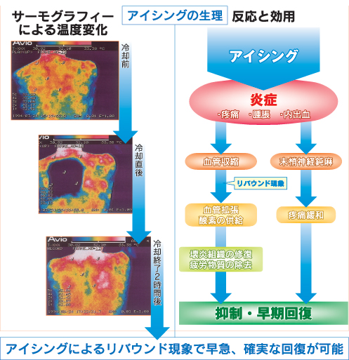 サーモグラフィーによる温度変化　アイシングの生理　反応と効用