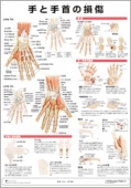 ミニポスター　手と手首の損傷