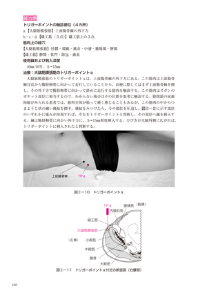 はじめてのトリガーポイント鍼治療