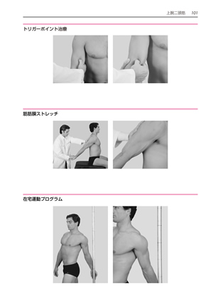 トリガーポイントと筋筋膜療法マニュアル